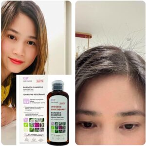 Dầu gội Elfa Pharm - Chống rụng tóc & kích thích mọc tóc - Ảnh 4