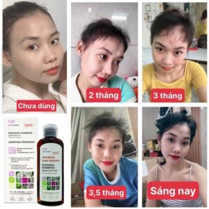 Dầu gội Elfa Pharm - Chống rụng tóc & kích thích mọc tóc - Ảnh 5