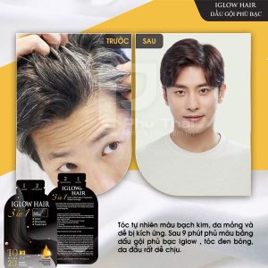 Dầu gội phủ bạc IGLOW HAIR Hàn Quốc - Ảnh 4