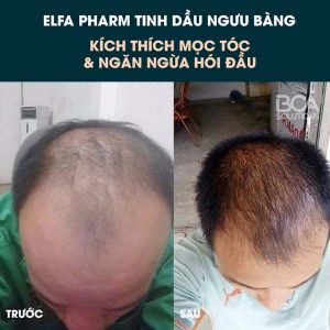 Serum ngăn ngừa rụng tóc và hỗ trợ mọc tóc Elfa Pharm - Ảnh 5
