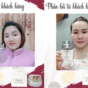 +Dr.Lee White Solution Dark Spot Reducer - Giải Pháp "Đánh Bay" Thâm Nám, Tìm Lại Làn Da Sáng Rỡ - Ảnh 3