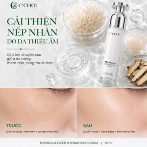 Serum cấp ẩm và Ngăn Ngừa Lão Hóa C'Choi - Tremella Deep Hydration Serum - Ảnh 3