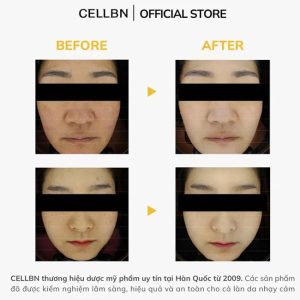 Serum Trắng Da Mờ Thâm Nám Glutathione 20.000ppm Chuẩn Y Khoa - Ảnh 4